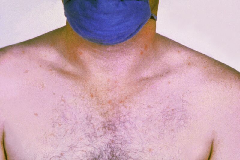 Plik:Salmonella typhi typhoid fever PHIL 2215 lores.jpg
