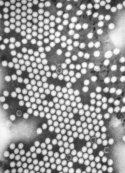 Plik:Polio EM PHIL 1875 lores.PNG