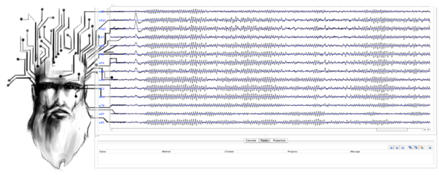 Svarog elektrowlosy EEG transp.png